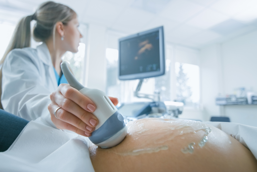 a pregnant woman getting an ultrasound