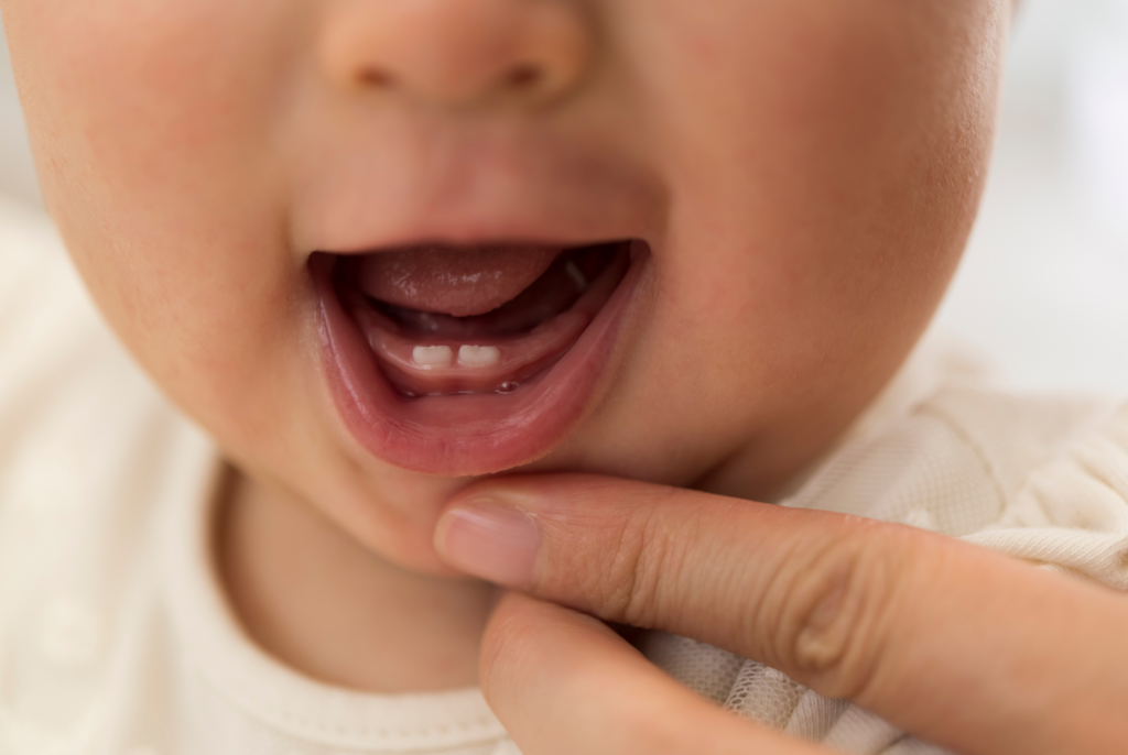 close up of a baby's mouth open with new teeth surfacing
